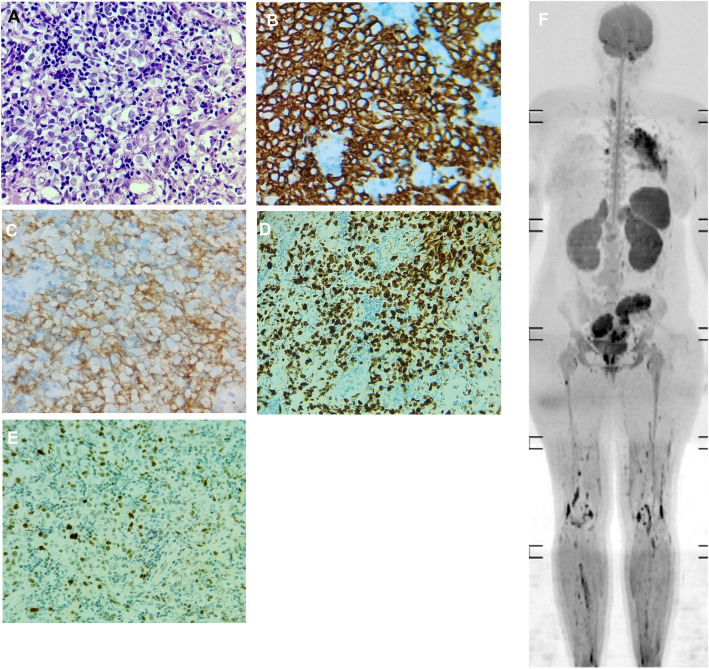 Figure 1
