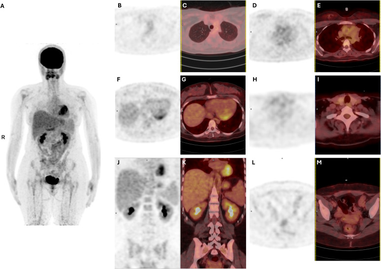 Figure 3