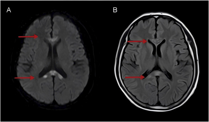 FIGURE 2