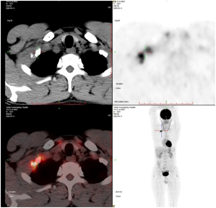 Figure 2