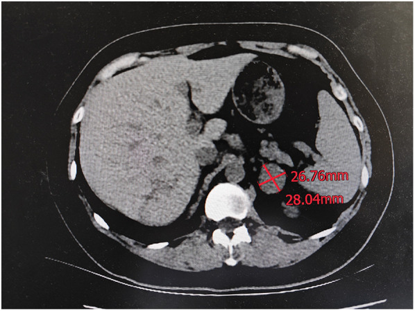 Figure 3