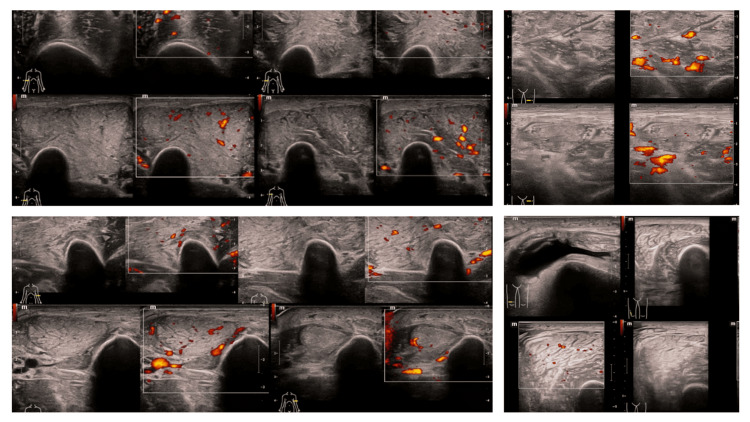 Figure 11