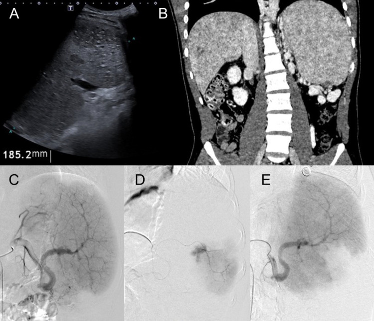 Figure 1