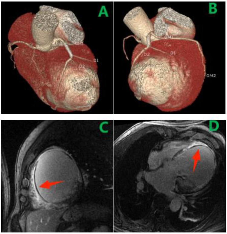 Figure 3