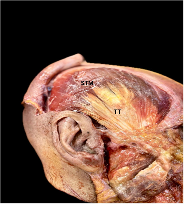 Figure 2