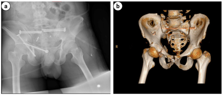 Figure 12