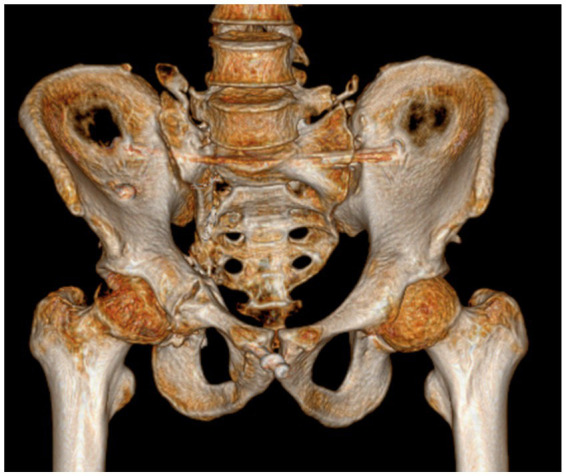 Figure 13