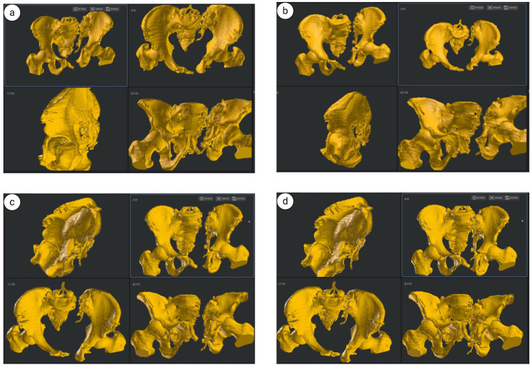 Figure 15