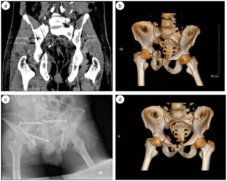 Figure 17