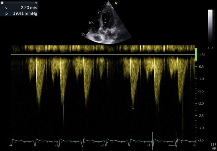 Figure 5