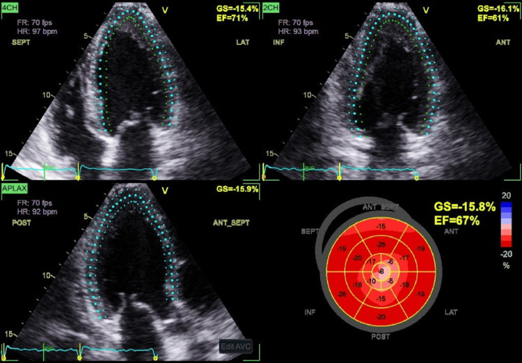 Figure 6