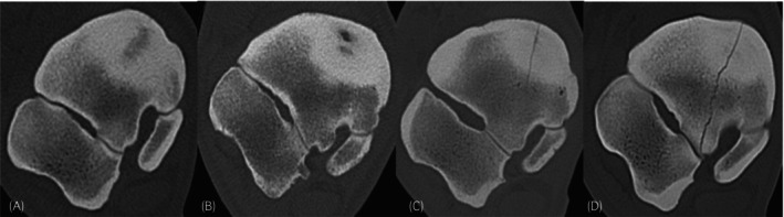 FIGURE 3