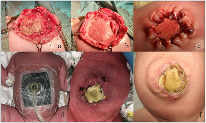 Figure 3