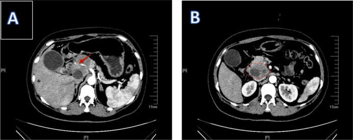 Figure 2