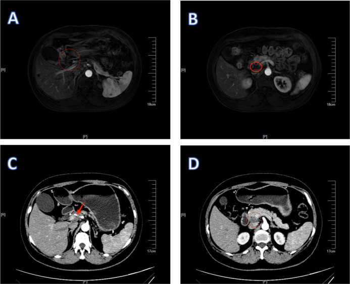 Figure 4
