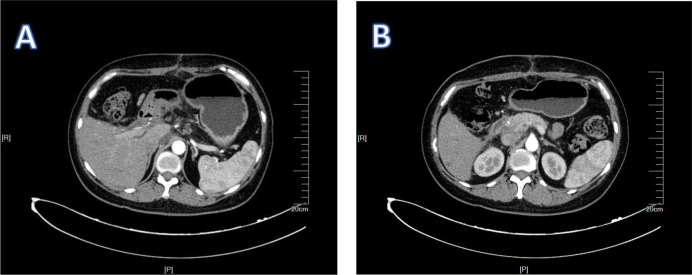 Figure 5