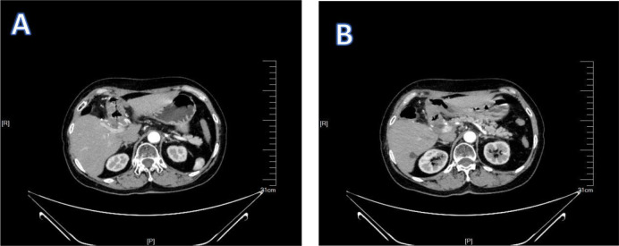 Figure 11