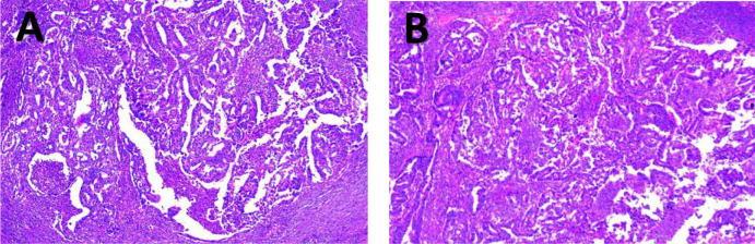 Figure 12