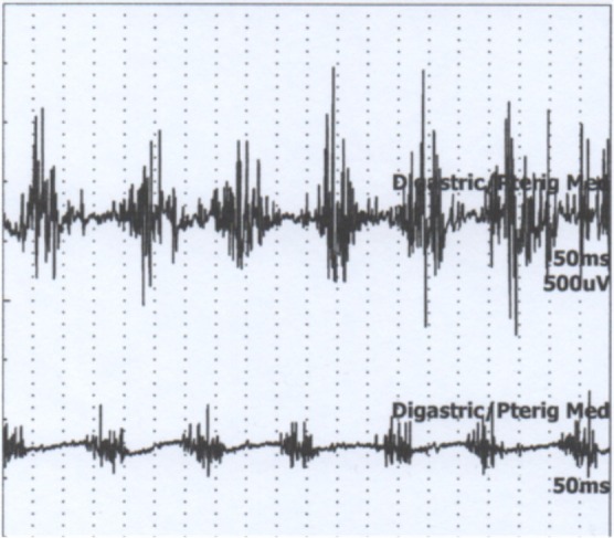 FIG. 1
