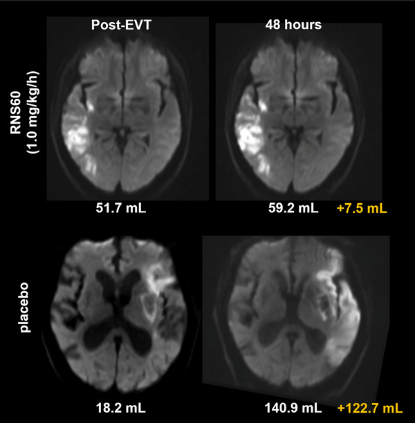 FIGURE 3