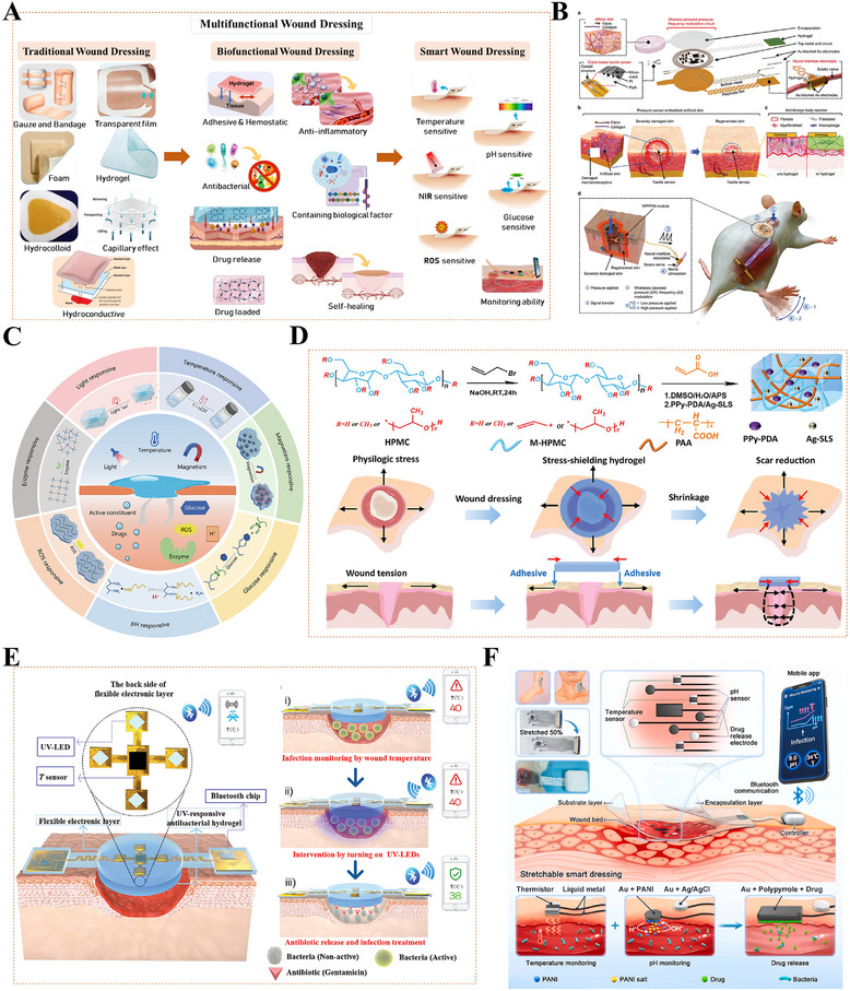 FIGURE 14