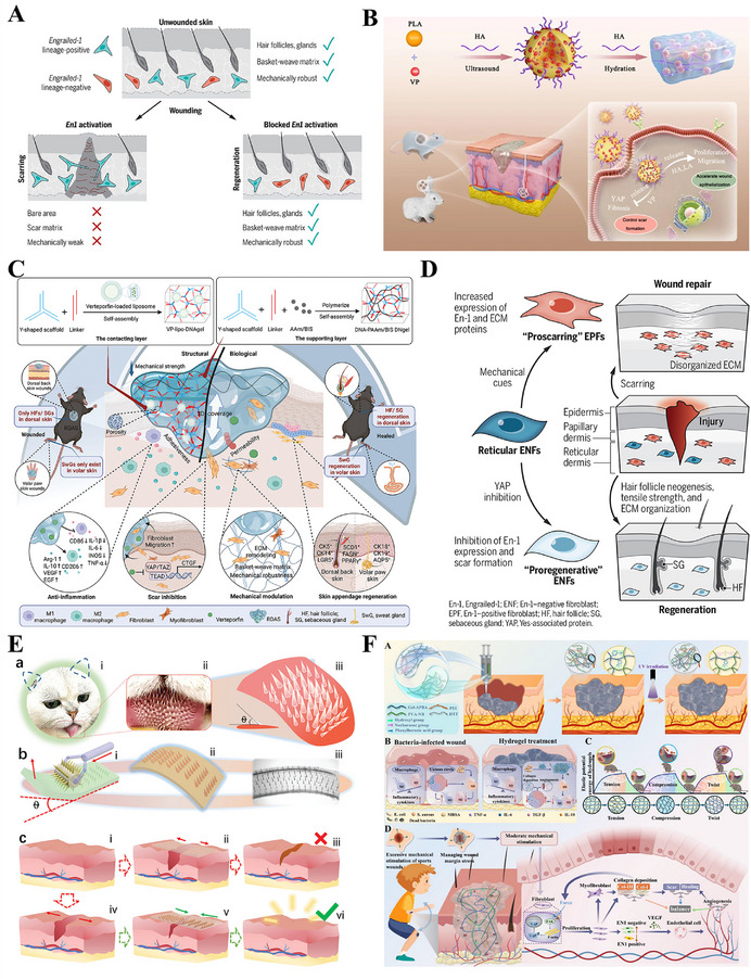FIGURE 11