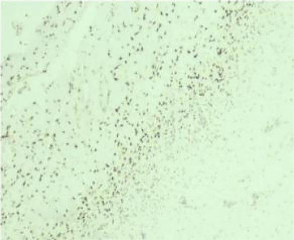 Figure 13