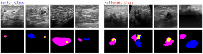 Figure 14