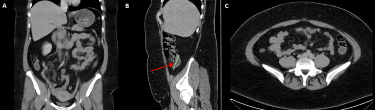 Figure 6