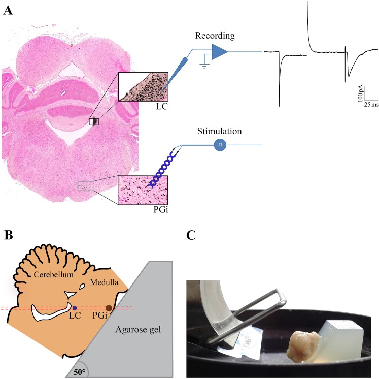 Fig 1