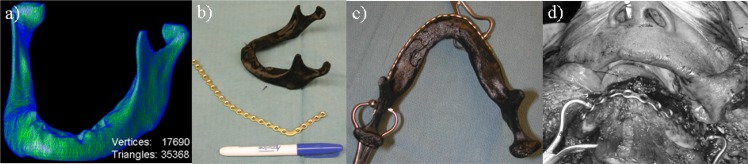 Fig 6