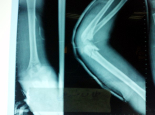 Fig.1A