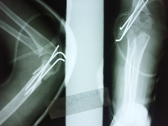 Fig.1B