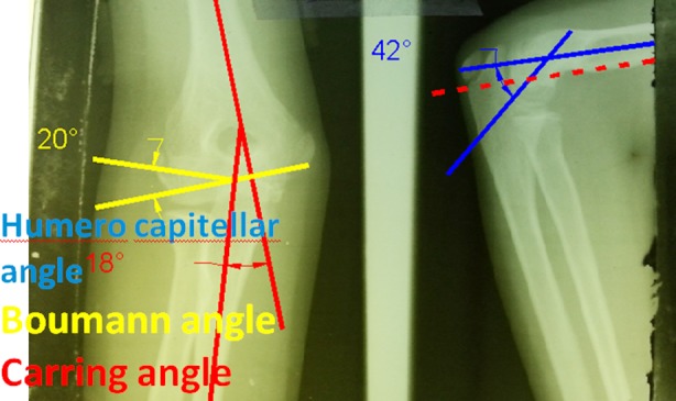 Fig.2