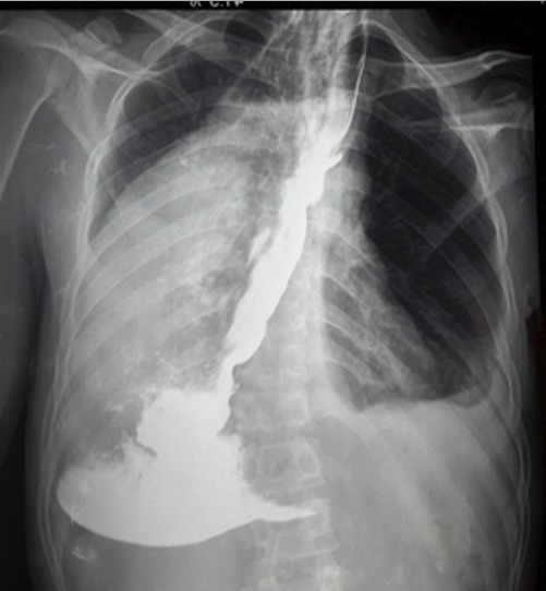 Figure 4