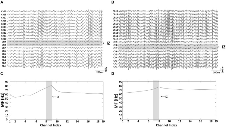 FIGURE 3