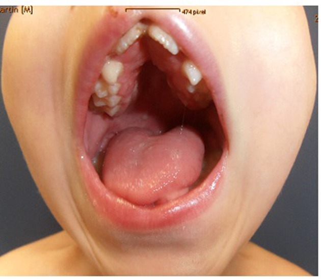 Figure 2