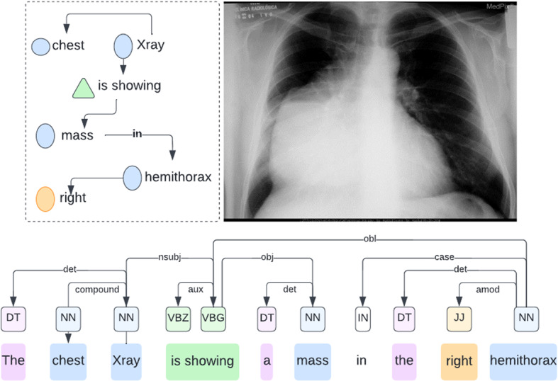 Figure 15